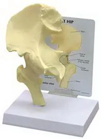 Alimed - GPI Anatomicals - 2970008285 - Anatomical Model Gpi Anatomicals Basic Hip Adult Full Size