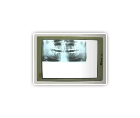 Dent Corp - 600 - E-View X-Ray Viewer