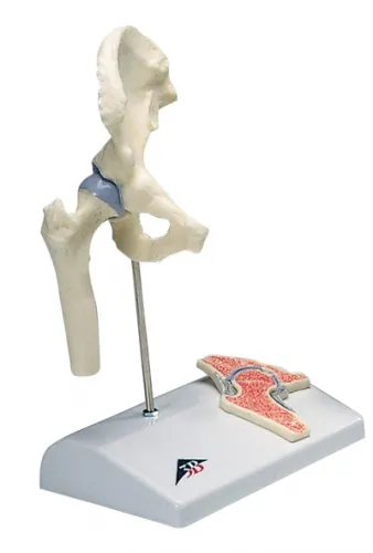 Fabrication Enterprises - From: 12-4517 To: 12-4520 - Anatomical Model mini hip joint with cross section of bone on base
