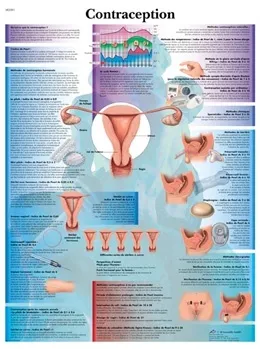 American 3B Scientific - VR2591L - Contraception Chart_FR_L
