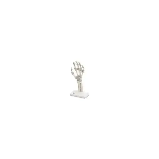 American 3B Scientific - M36 - Hand Left With Elastic Ligaments